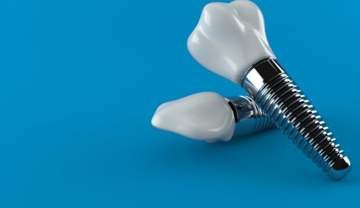 神奈川でオールオン4を受けるならどこ？おすすめ医院や選ぶポイントを紹介