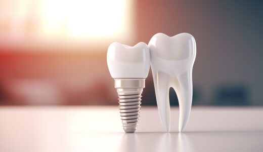 オールオン4が安いクリニックは危険！？その理由と費用相場を紹介