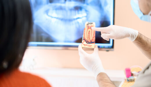 ボロボロの歯を綺麗にしたい…気になる治療法や費用・医院選びを紹介