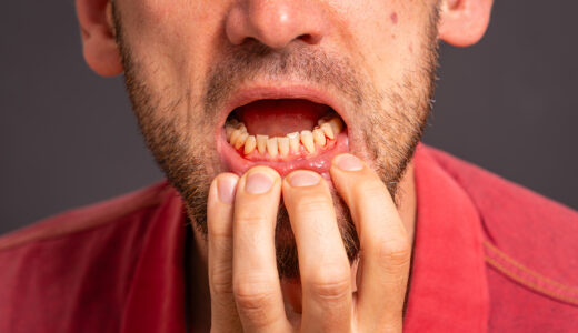 虫歯の見分け方をプロの歯科医が解説！見た目や痛みなど確実な確認方法